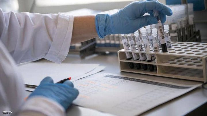 France tests plasma to cure coronavirus